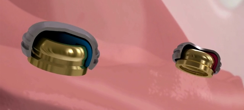 ロケーターアタッチメントシステム