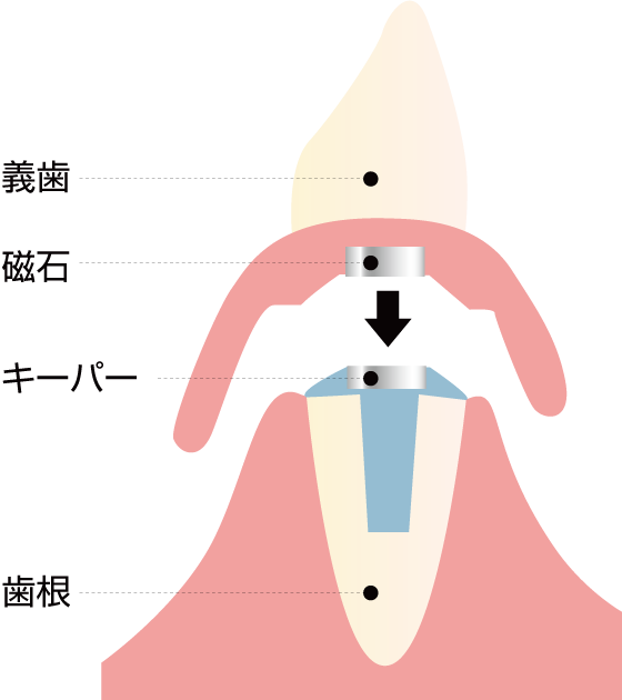 磁性アタッチメント