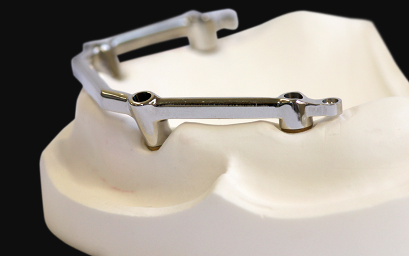 バーアタッチメント