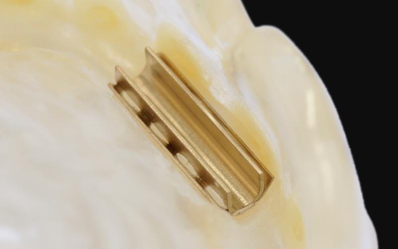 バーアタッチメント