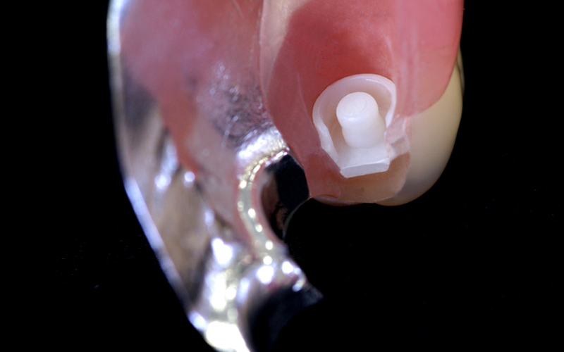 ERAアタッチメント