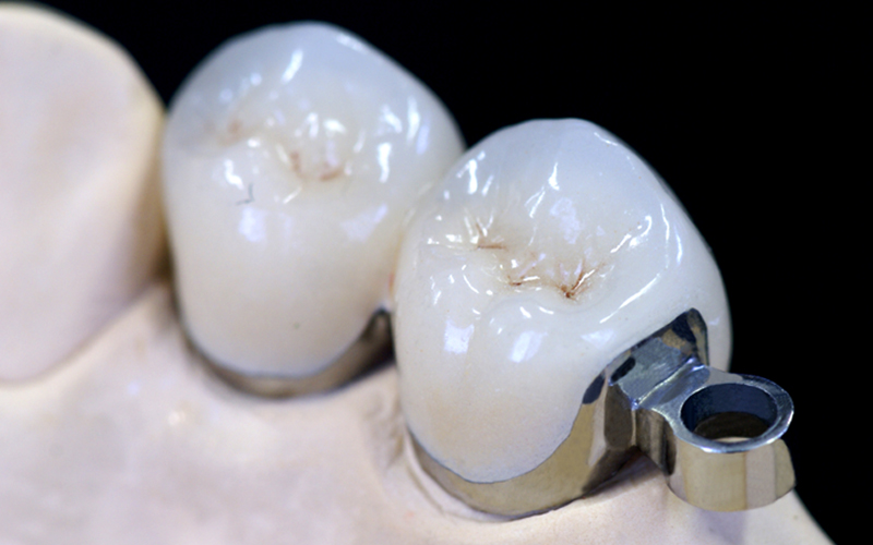 ERAアタッチメント