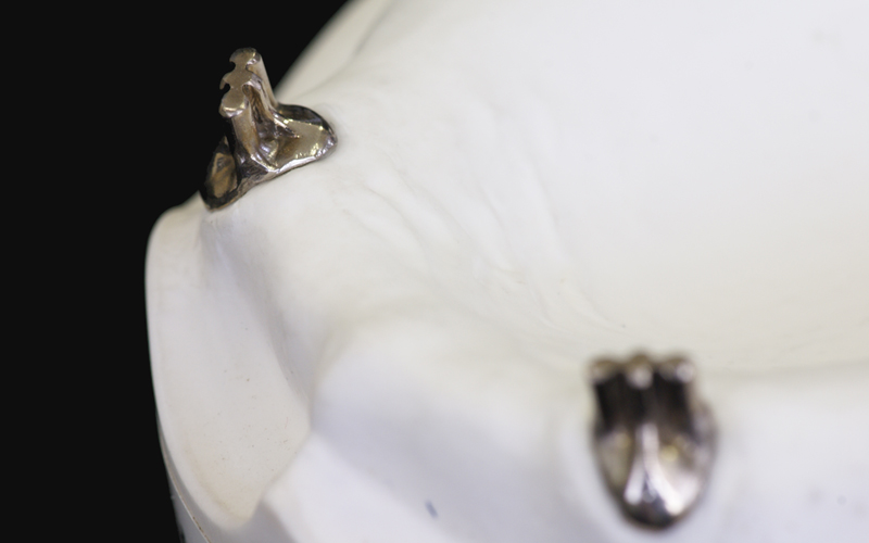 OPアンカーアタッチメント