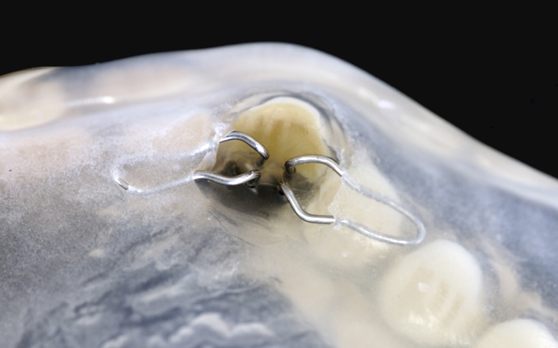 OPアンカーアタッチメント