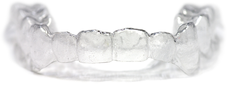 クリアアライナー