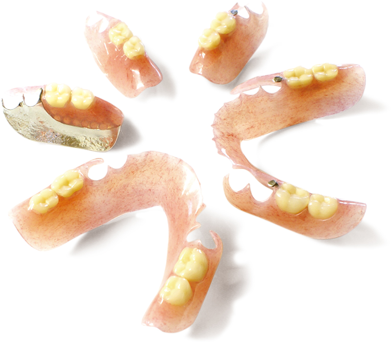 ノンクラスプデンチャー